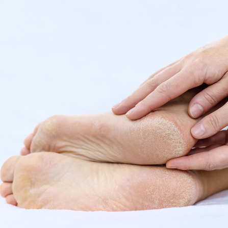 Soins des pieds : Retrouvez nos crèmes sur Pharmazon.fr